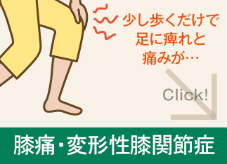 膝痛・変形性膝関節症